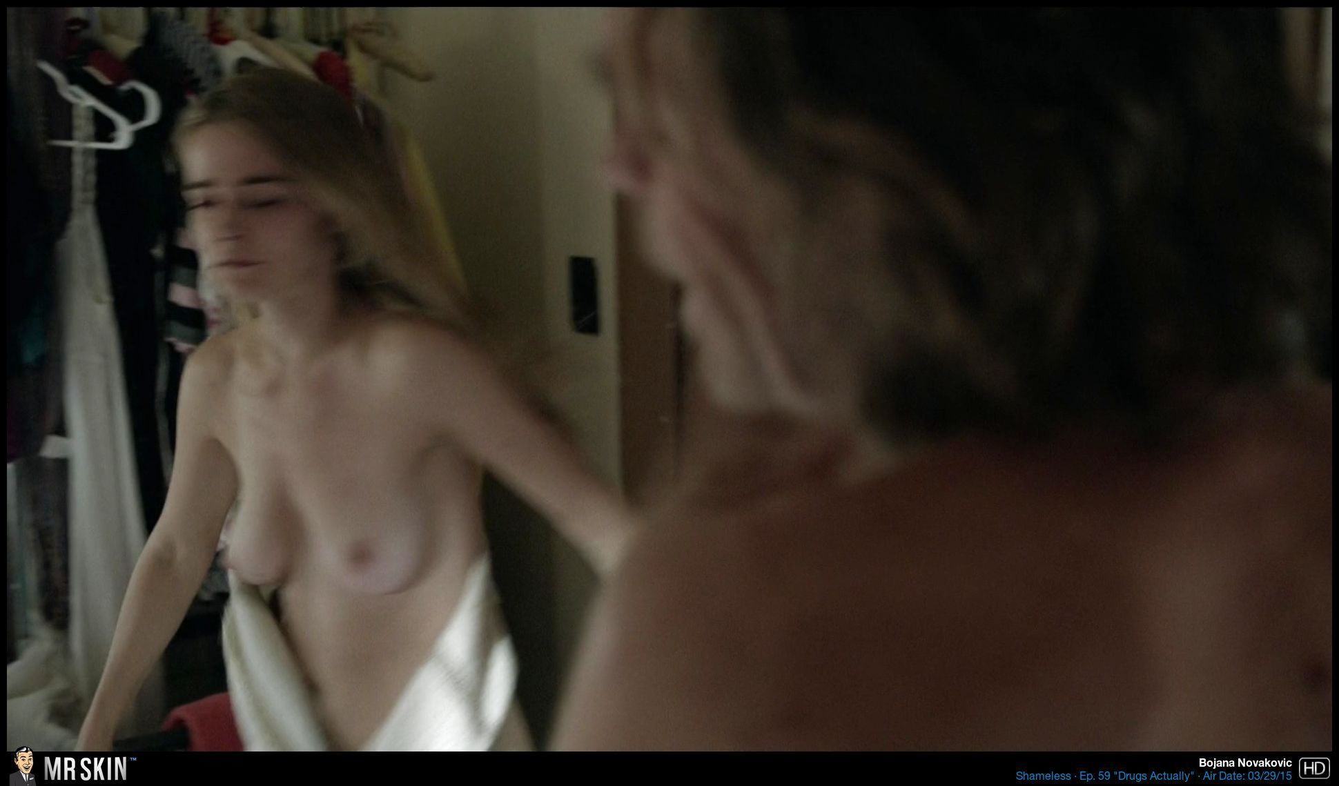 Tv Nudity Report Shameless, Critical, Spotless-2227